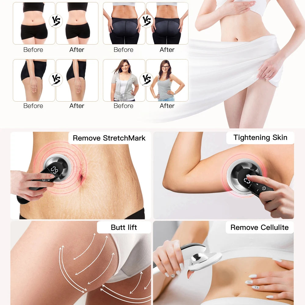 Electric Lose Weight Body Massager Hot Compress Heating Fat Burning Slimming Home Use Anti-Cellulite Massage Device