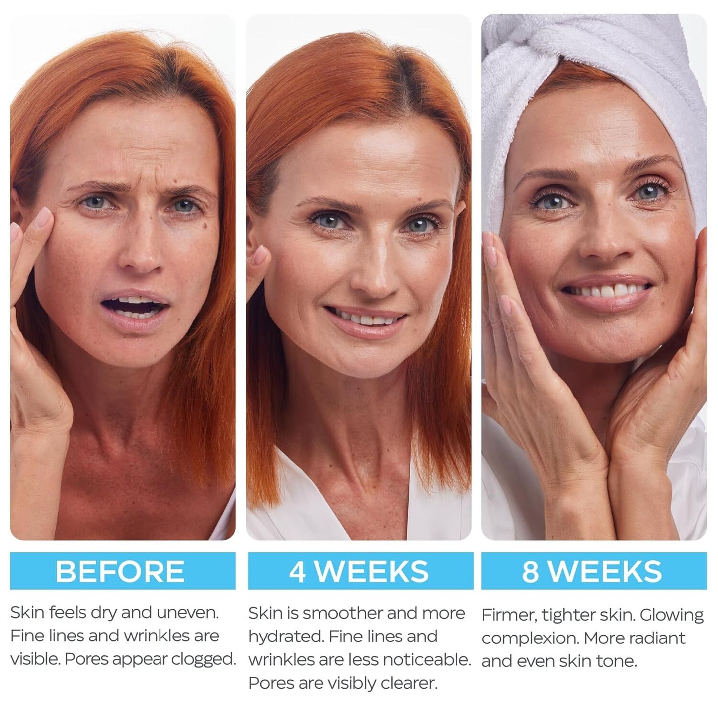 Retinol Cream for Face with Hyaluronic Acid, anti Aging Wrinkle Cream for Women