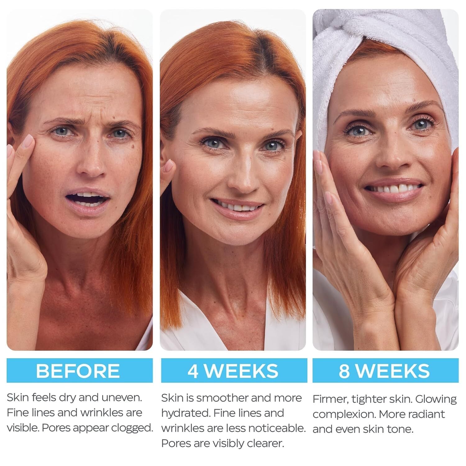 Retinol Cream for Face with Hyaluronic Acid, anti Aging Wrinkle Cream for Women